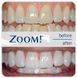 Philips Zoom (Філіпс зум) NiteWhite 16%, Carbamida Peroxide, 6 шприців &ndash; персональний набір для відбілювання зубів. 2516704945 фото 7