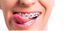 Sunstar (Санстар) GUM Ortho Orthodontic, 75 мл - зубна паста для ортодонтичних брекетів. 2553822883 фото 4